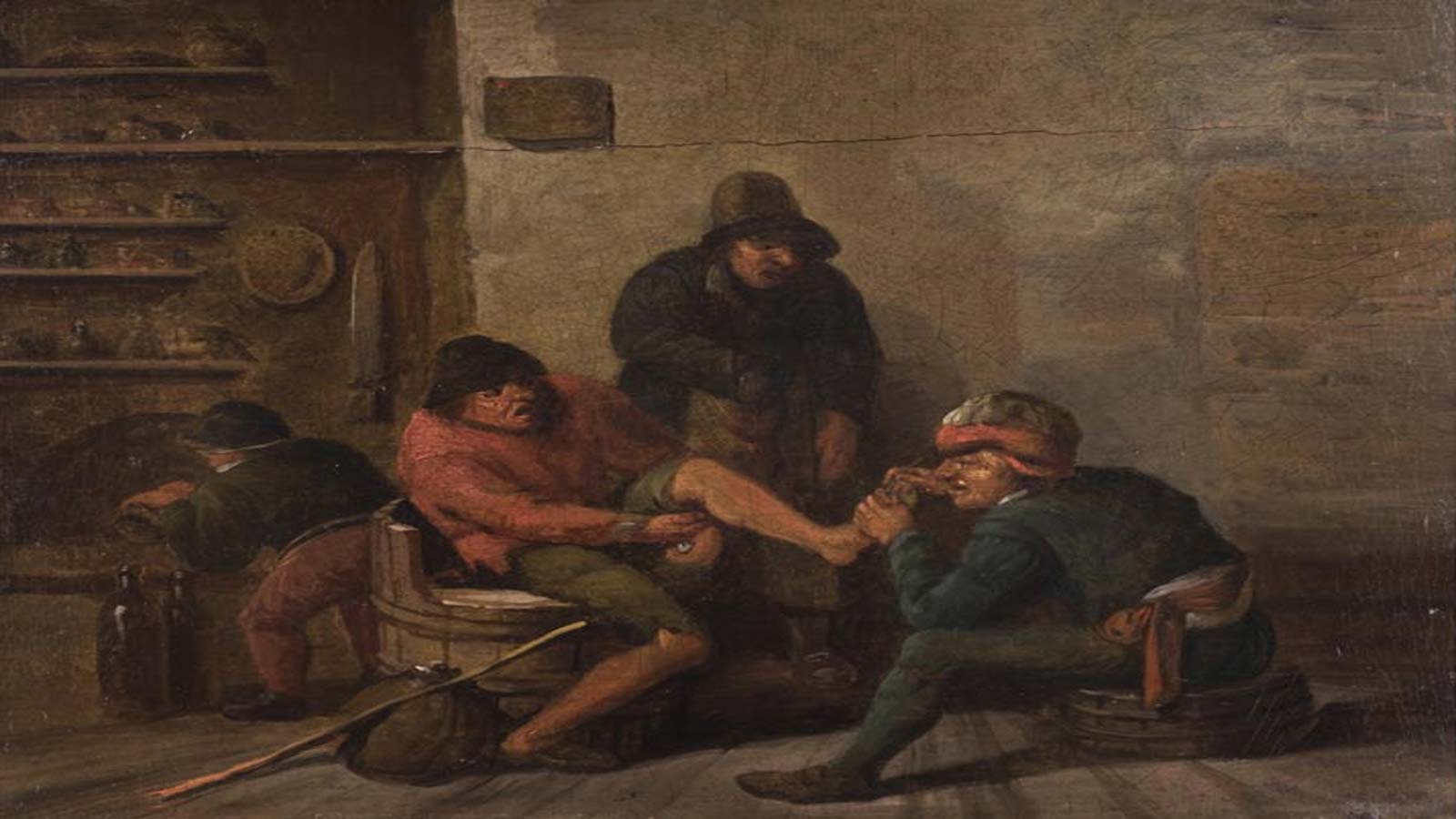 edema patient