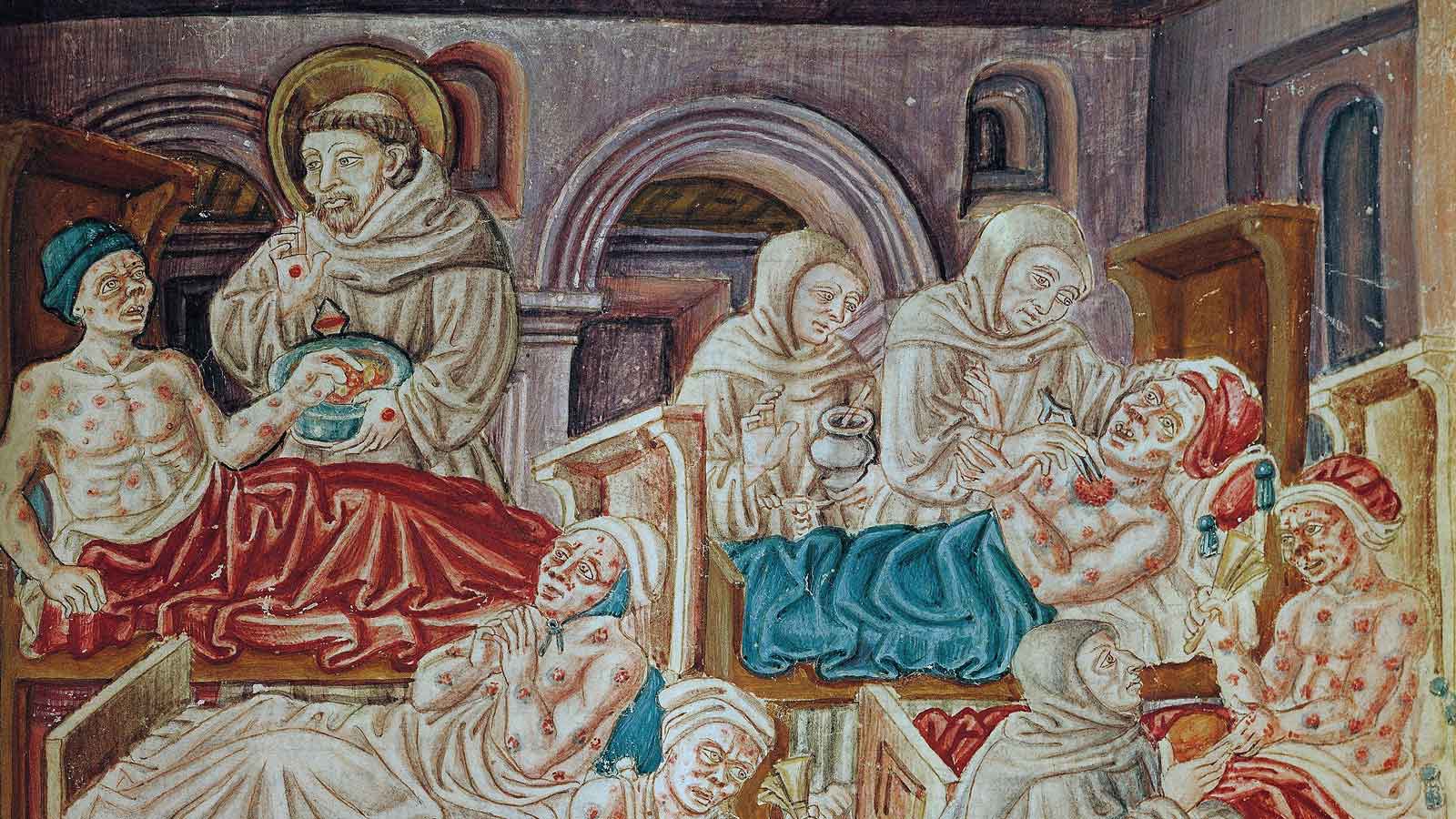 painting medieval smallpox